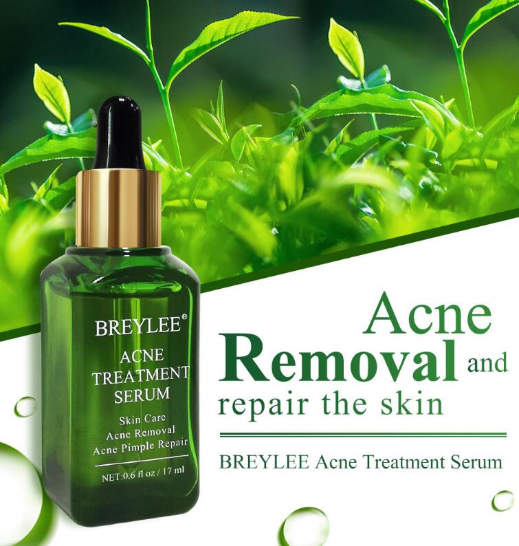 Acne Treatment Serum Facial Repair Oil